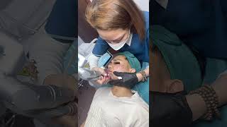 Skin Treatment — Acne, Scars, Pores