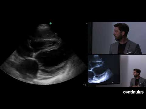 Master Shock Ultrasound with the Echo-Guided Life Support Course