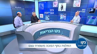 החלפת כתף הפוכה משמרת עצם - פרופ' אהוד אטון