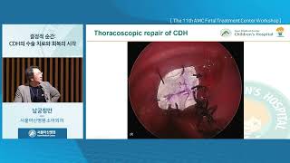 The 11th AMC Fetal Treatment Center Workshop : 결정적 순간: Congenital Diaphragmatic Hernia의 수술 치료와 회복의 시작  미리보기