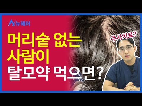 머리숱 없는 사람에게 탈모약, 주사치료가 좋을까? l 우리끼리 탈밍아웃 l 뉴헤어