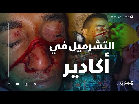 "شمكار" يشوه وجه شاب بسلاح أبيض ويخرب الممتلكات الخاصة لساكنة الدراركة بأكادير