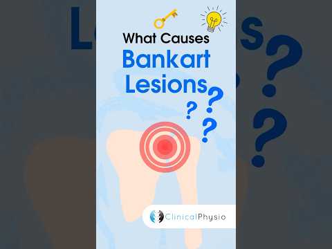 Bankart Lesions Explained #physicaltherapy #physiotherapy #shoulder