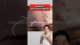 Download lagu Do you have freckles on your face? You need to pay attention and take care of it! #skincare #skin... mp3