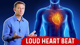 Why is Your Heart Pounding so Loud – Dr. Berg on Heart Palpitations