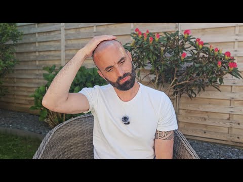 Do I regret my hair transplants?