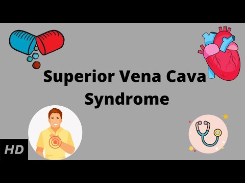 Superior Vena Cava syndrome, Causes, Signs and Symptoms, Diagnosis and Treatment.