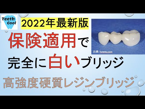 スコットランド