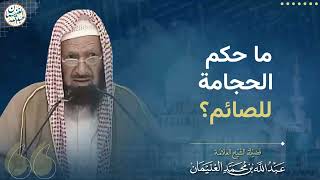 صورة ما حكم الحجامة للصائم؟