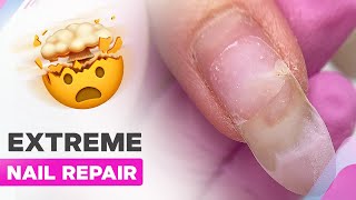 Nail Strengthening Mistakes | Fixing Broken Nails | Spring Nail Art