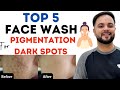 Top 5 Whitening Facewash to Remove Pigmentation & Dark Spots