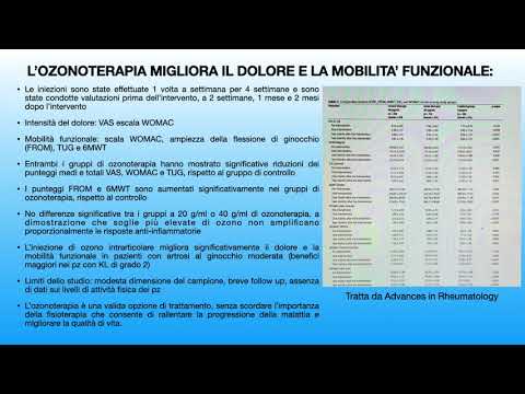 Una buona notizia per chi soffre di artrosi al ginocchio