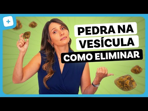 Gallstones: main symptoms and ideal diet