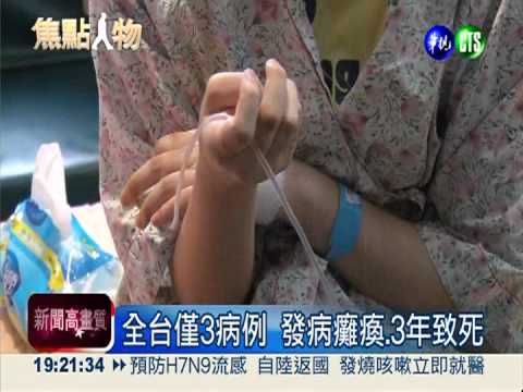 17歲少女罹罕病 智力倒退剩5歲