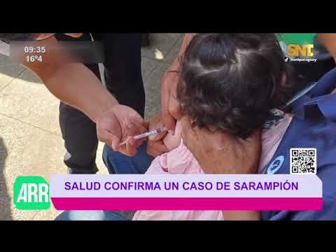 Confirman caso de sarampión en San Pedro tras 10 años sin circulación del virus en Paraguay