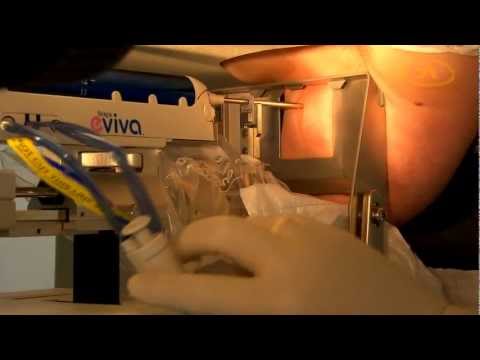 Prostata-Massage in Bildern. Tr Prostata