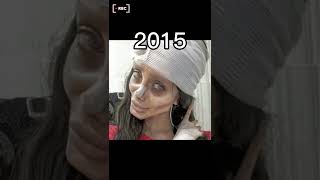 Download lagu INILAH KASUS OPERASI PLASTIK YANG GAGAL 😱 #shortsfeed #shorts #shortsyoutube mp3 Download lagu INILAH KASUS OPERASI PLASTIK YANG GAGAL 😱 #shortsfeed #shorts #shortsyoutube mp3