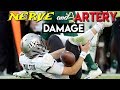 WORST College Football Injury Ever Doctor Reviews McKenzie Milton Injury