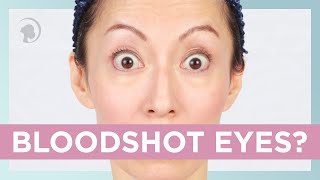 How to Get Rid of Bloodshot Eyes with Face Yoga