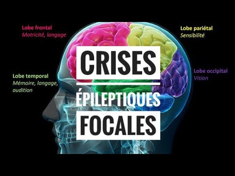 Les Epilepsies - partie 03 (Les Crises Focales, Les Etiologies)