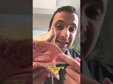 Technique to control nosebleeds! #shorts