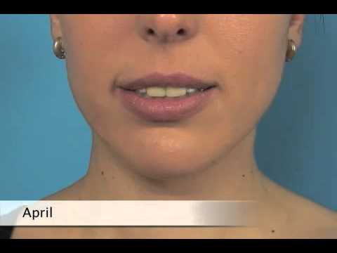 エイプリル」をネイティブのように発音してみましょう。 (Pronounce 'April' like a native English speaker!)