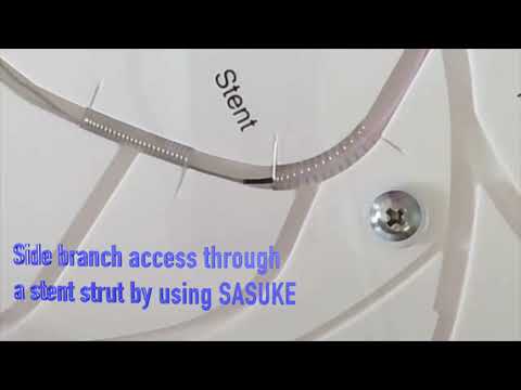 Angioplasty technique: Side branch access by using SASUKE