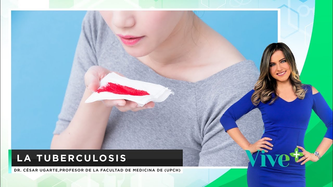 Tuberculosis (TBC) - Diagnóstico y tratamiento | Vive Más - #ConsultorioEnLínea