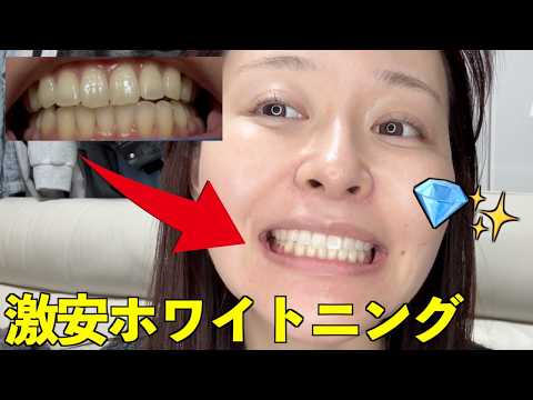 youtube-美容・ダイエット・健康記事2026/03/11 08:23:49