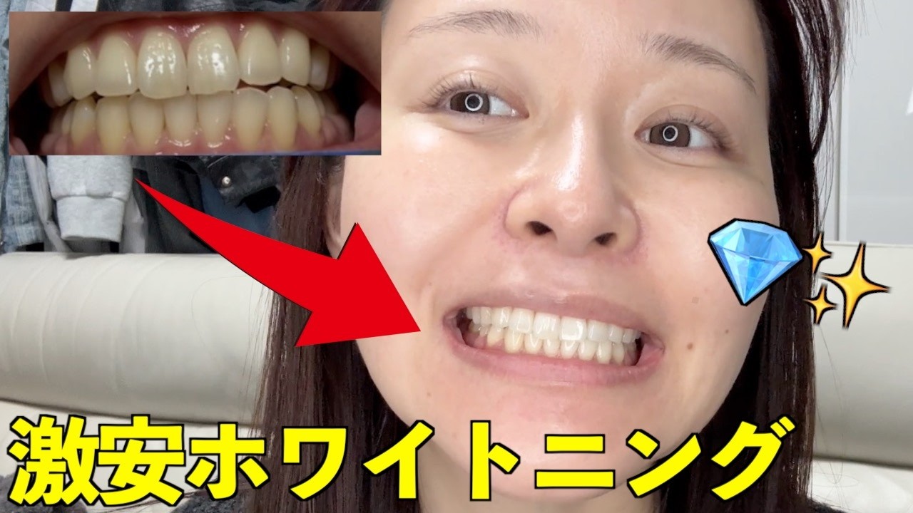 【家で20分】ケチ女は月100円で歯白くしてます🦷