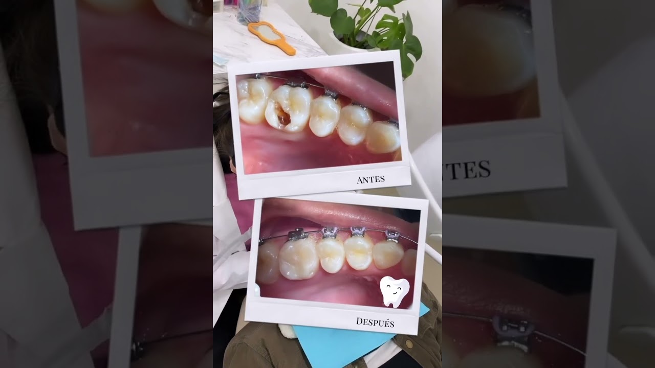 Dhamar De La Rocha Almazan-9