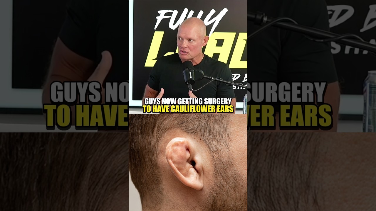 People Are Getting Surgery to Look Like UFC Fighters.