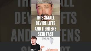 Watch This Tiny Device Lift And Tighten Skin Fast