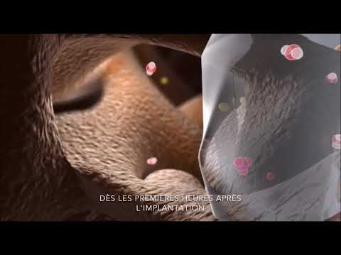 GlassBone - NOVETECH SURGERY