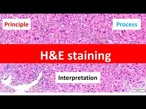 HE Staining: Principle, Procedure, and Interpretation | Haematoxylin and Eosin Staining |