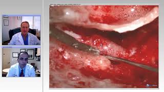 Download Lagu Technical Nuances for Managing Challenging Cases (Preview) Thumbnail