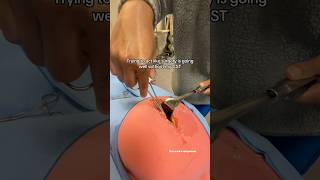 What is a Certified Surgical Technologist?