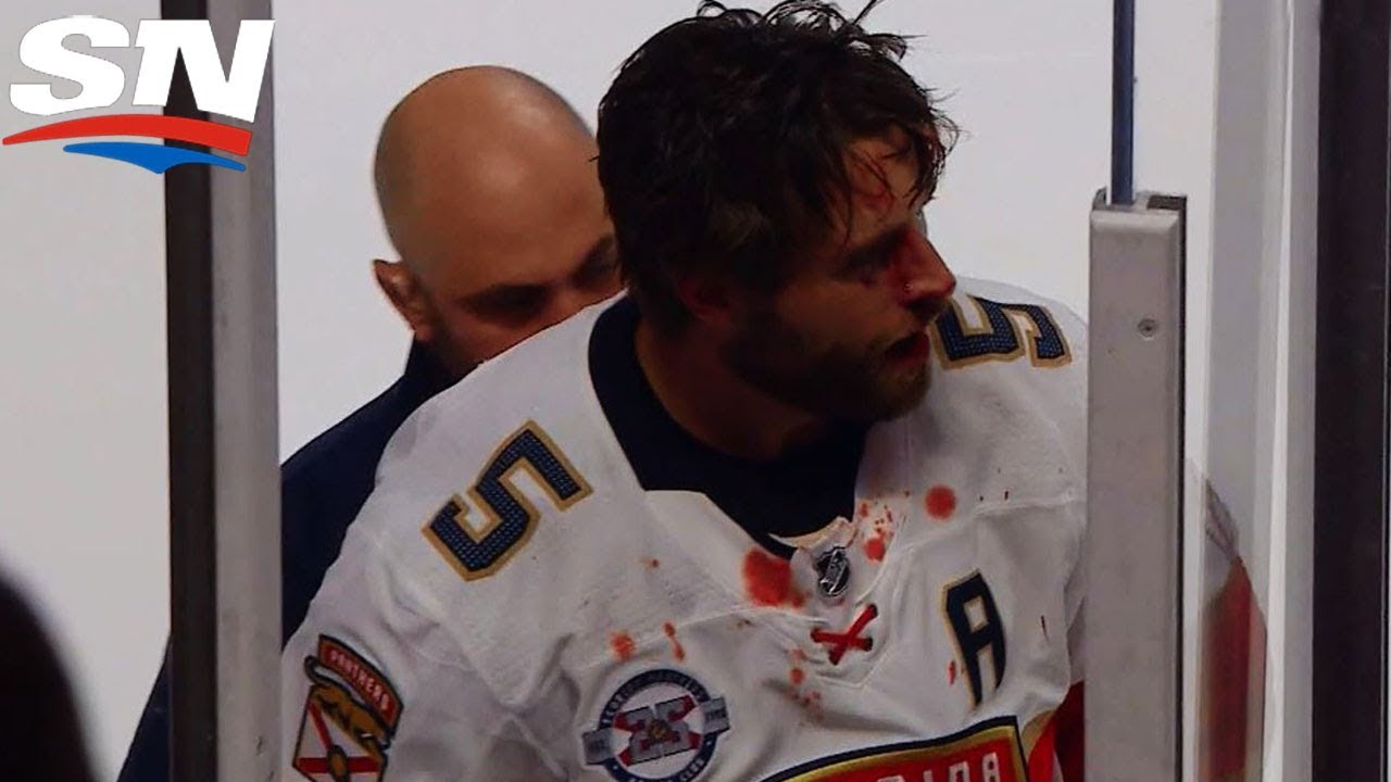 Aaron Ekblad tente de nous faire croire qu'il n'attaquera pas Max Domi.