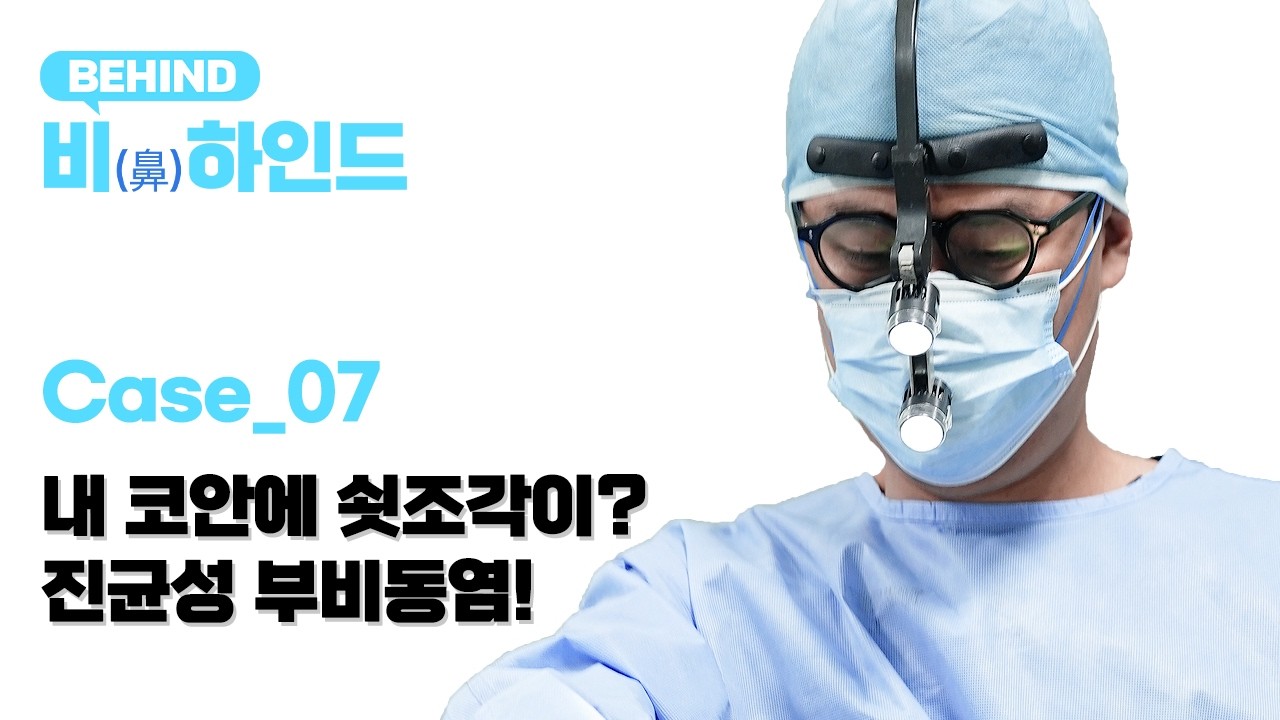 Case 07_내 코안에 쇳조각이? 진균성 부비동염(비하인드)