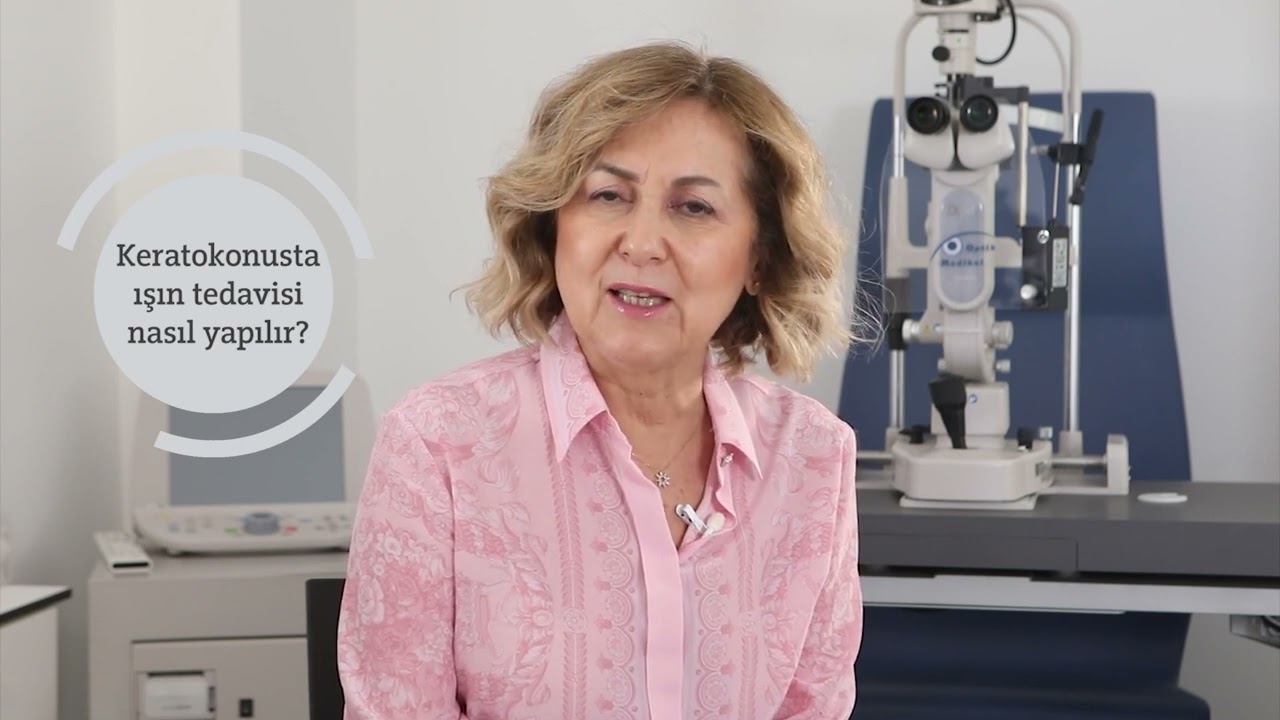 Keratokonusta Işın Tedavisi Nasıl Yapılır?