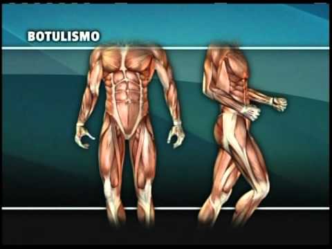 Repórter Brasil explica - Botulismo
