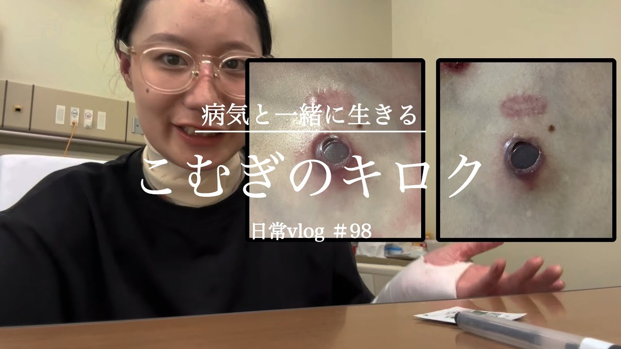 【表皮水疱症】身体にあいた穴を治す入院です　日常vlog ＃98