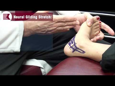 Stretches to Treat Your Nerve Pain