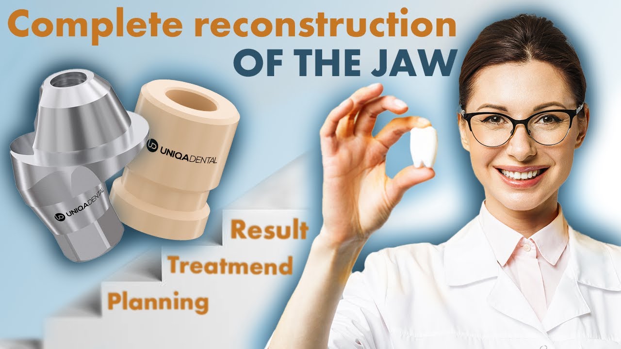 Dental case of screw retained restoration on implants using multi units