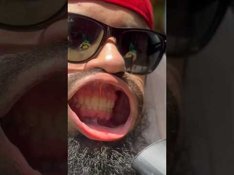 Mussa was challenged!!!