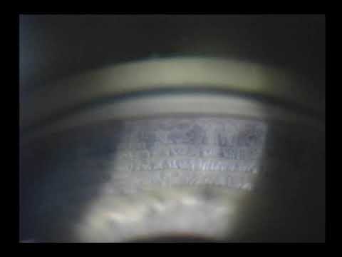 Keratometer