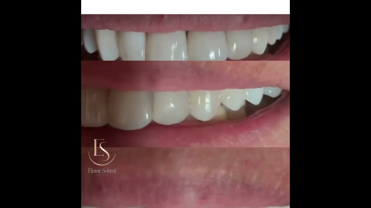 Elaine Sobral Leite-24