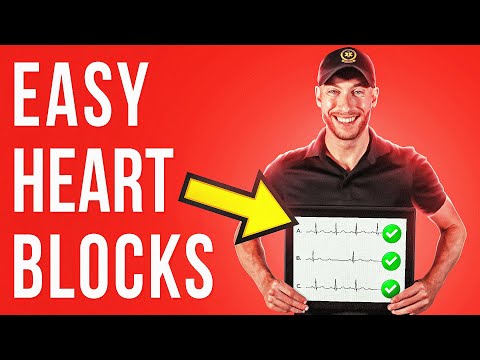 NEVER MISS HEART BLOCKS Again...