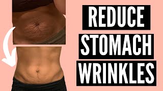 HOW TO GET RID OF STOMACH WRINKLES POSTPARTUM NATURALLY | NOT DERMAROLLING | TIGHTEN LOOSE SKIN