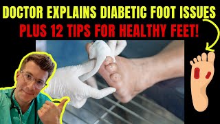 Doctor explains DIABETIC FOOT COMPLICATIONS - PLUS 12 TIPS FOR PREVENTION!